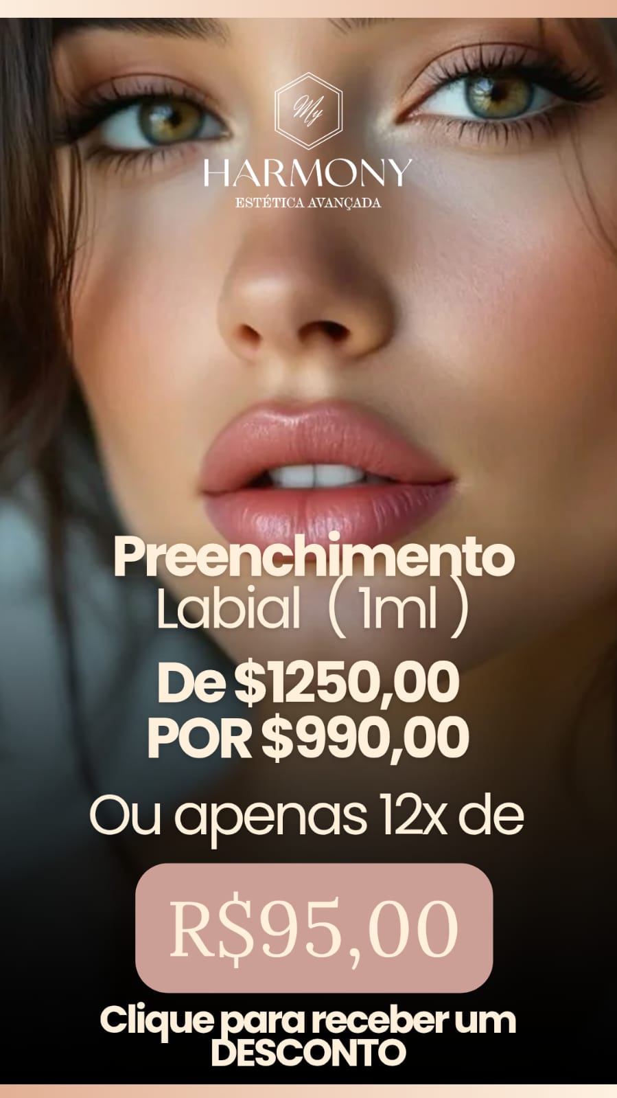 Preenchimento Labial por R$ 990,00
