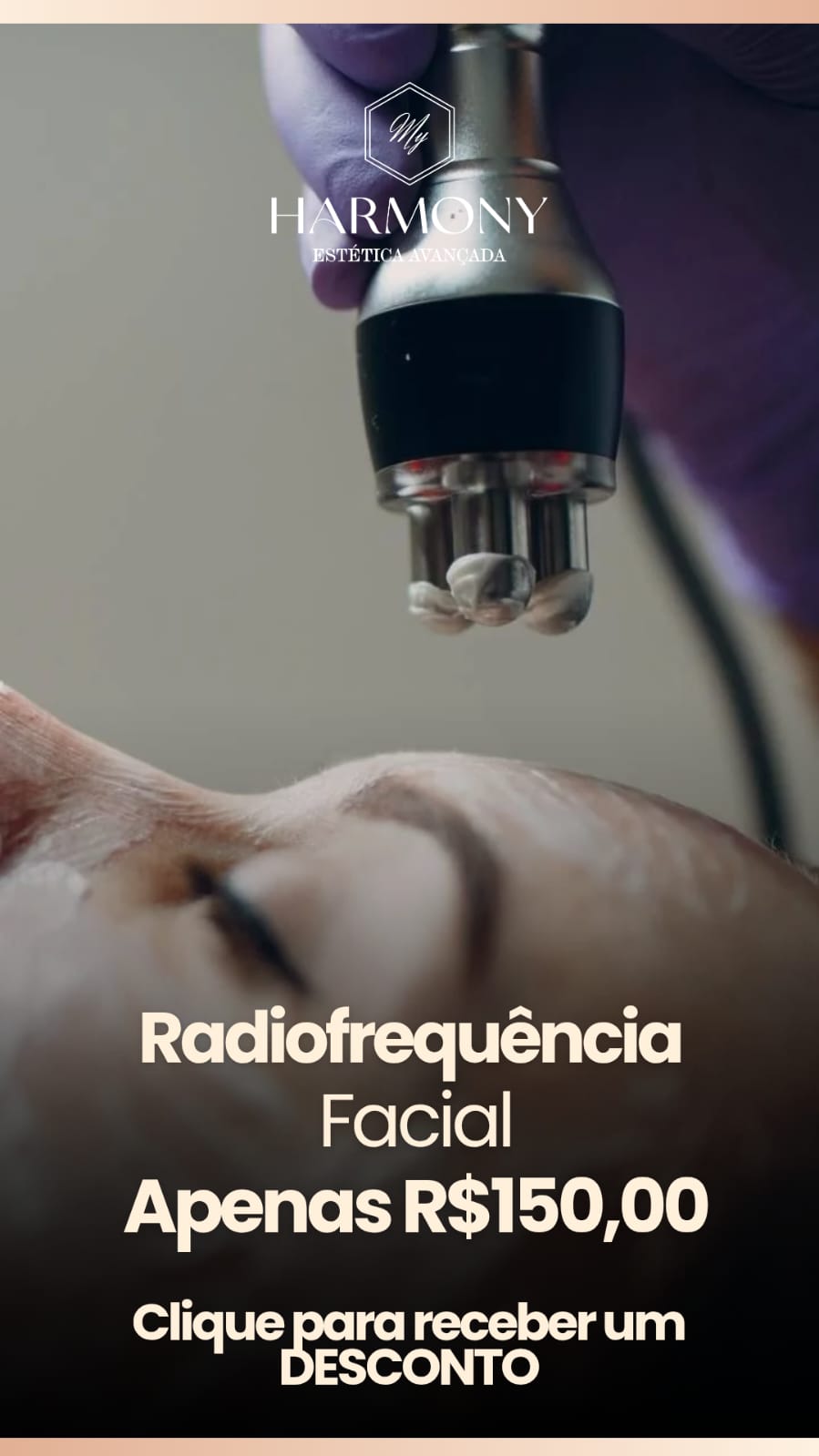 Radiofrequência Facial por R$ 150,00